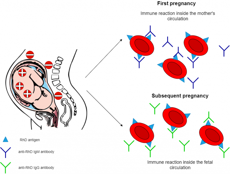 hemolytic disease of the newborn case presentation